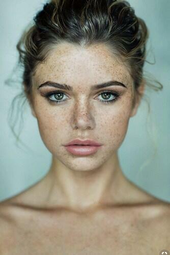 กระเกิดจากอะไร, ผิวเป็นกระ