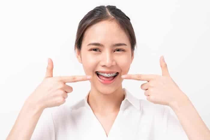 ดัดฟันใสราคา, ดัดฟันมีกี่แบบ