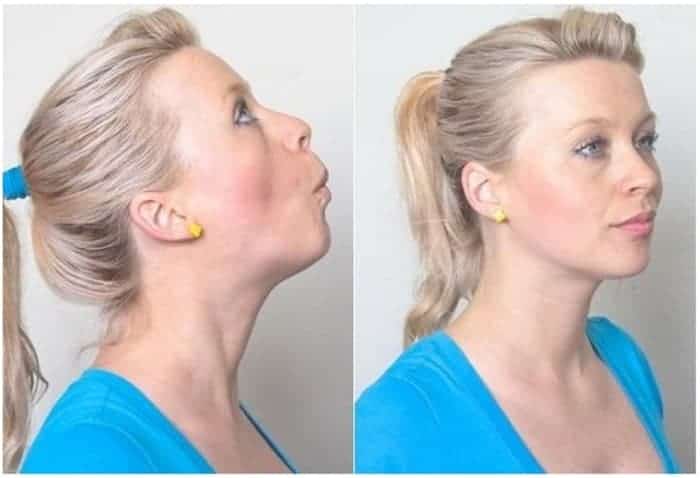 ลดแก้มลดเหนียง, วิธีลดแก้มเหนียง